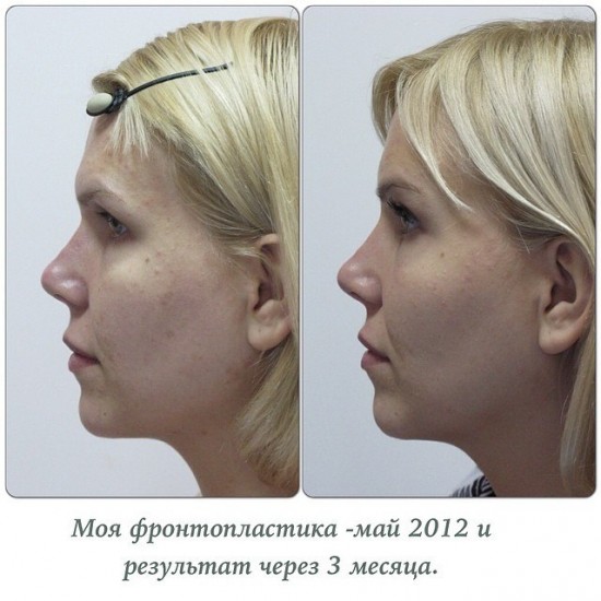 Анна Белль