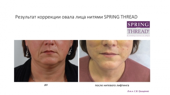 Интервью c пластическим хирургом. Вся правда об индустрии красоты