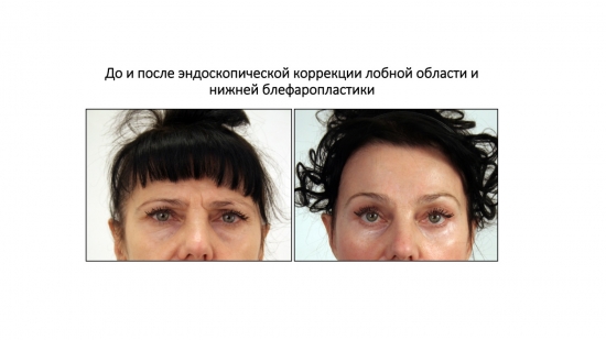 Интервью c пластическим хирургом. Вся правда об индустрии красоты