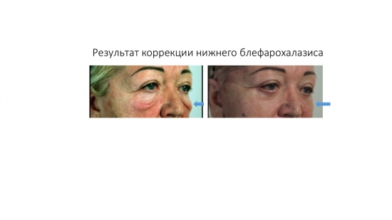 Интервью c пластическим хирургом. Вся правда об индустрии красоты
