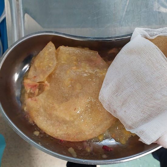 Сдувшаяся Кудрявцева